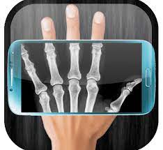 Real Xray Scanner APK icon